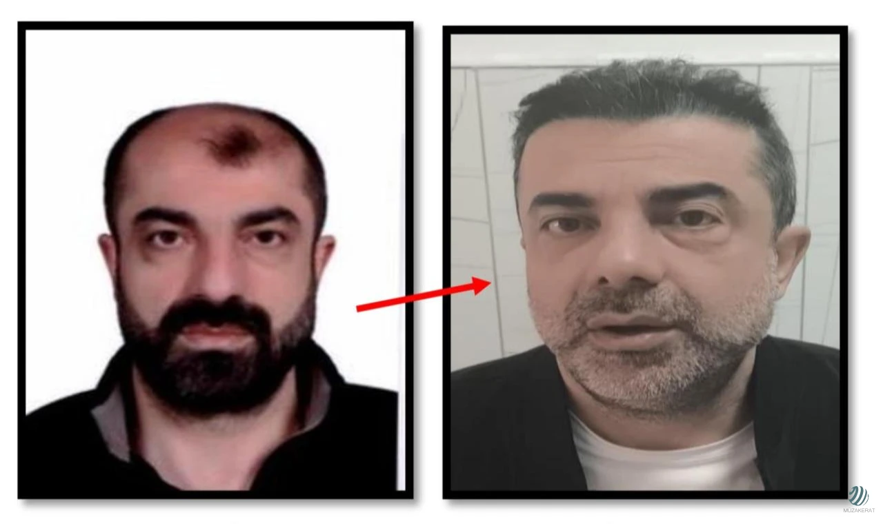Estetikle yüzünü değiştiren cinayet zanlısı yakalandı