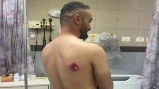 GÜNCELLEME AA’nın Ortadoğu Editörü İsrail polisinin Mescidi Aksa’daki müdahalesinde yaralandı