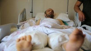 Mardin’de cam kemik hastasına cerrahi müdahale