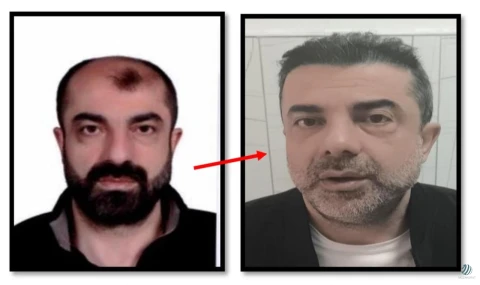 Estetikle yüzünü değiştiren cinayet zanlısı yakalandı